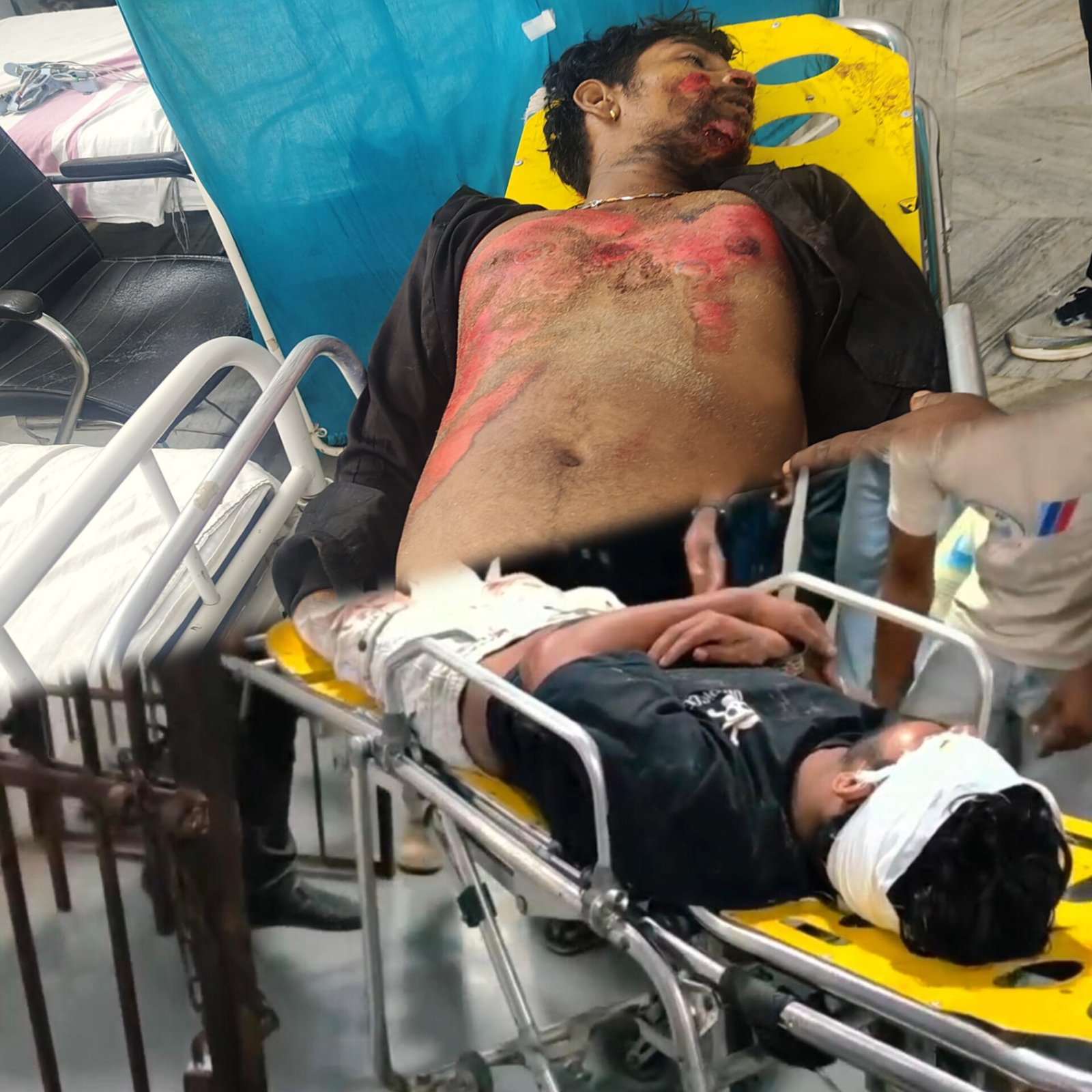 Court Escort Vehicle Collision Claims One Life, Another Critical on Puri-Konark Road